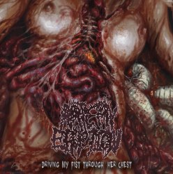 ARTERY ERUPTION -Driving My Fist Through Her Chest CD Brutal Death Metal