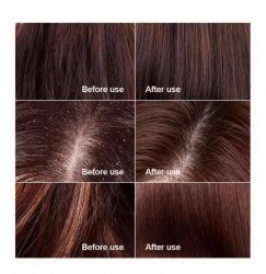 Шампунь от перхоти KAVERN, 500 мл. / арт. 283-14