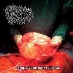 FOETAL FLUIDS TO EXPURGATE - Cyclic Vomiting Syndrome CD Goregrind