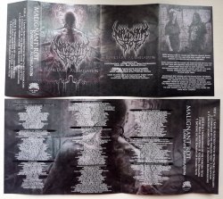 MALIGNANT ROT - Planetary Assimilation Tape Brutal Technical Death Metal