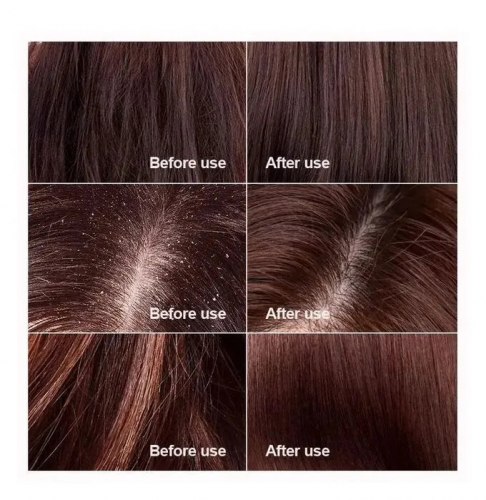 Шампунь от перхоти KAVERN, 500 мл. / арт. 283-14